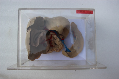 猪肝胰十二指肠